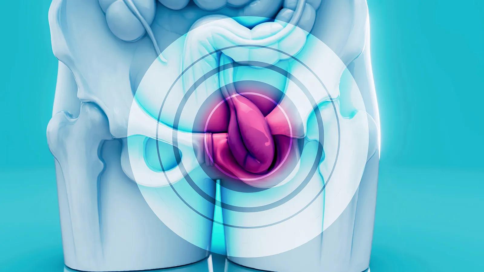 Andrological<br>Check-Up Programs