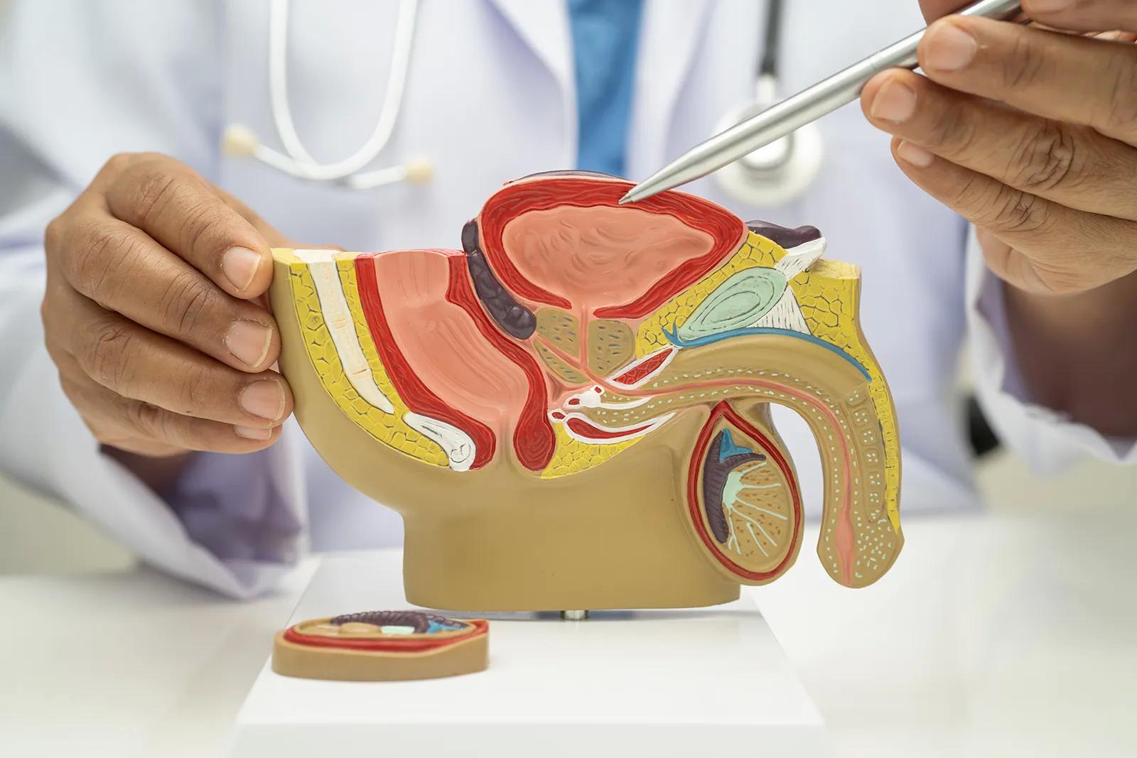 Balloon Dilatation for Urethral Stricture